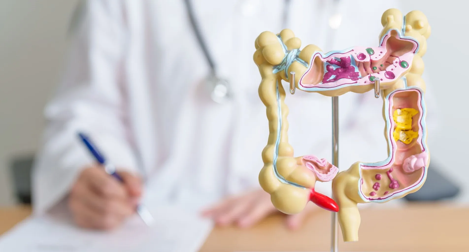 Rectal Cancer in Melbourne